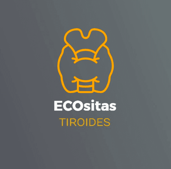 Artículo: revisión del manejo de los nódulos tiroideos